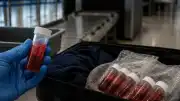 Bilim İnsanları Mpox Virüsü İçeren Numuneleri Usulsüz Getirmekle Suçlanıyor