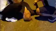 Aydın'da Çıkan Kavgada Bir Kişi Başından Yaralandı