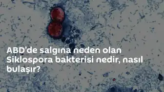 ABD'de Siklospora Bakterisi Artışı: Enfeksiyonun Nedeni ve Bulaşma Yolları