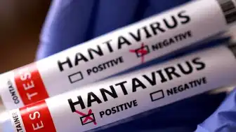 Sağlık Bakanlığı: Hantavirüs vakası Türkiye'ye getirilen 3 kişide görülmedi