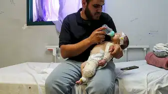 İsrail Saldırısında Annesini Kaybeden Bebek Muhammed'in Bacağı Ampute Edildi