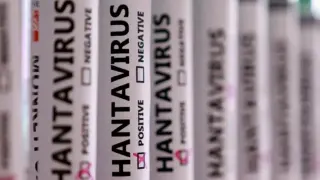MV Hondius Gemisinde Hantavirüs Salgını: Üç Can Aldı, Kayıp Numuneler Şüpheli