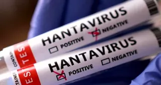 Sağlık Bakanlığı: Hantavirüs vakası Türkiye'ye getirilen 3 kişide görülmedi
